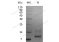 Recombinant Human IGF-1/IGF1 Protein (aa 52-118) – Figure 1 of 3