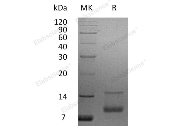 Recombinant Human IGF-1/IGF1 Protein (aa 52-118) – Figure 1 of 3