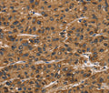 ATP7A Polyclonal Antibody – Figure 1 of 3