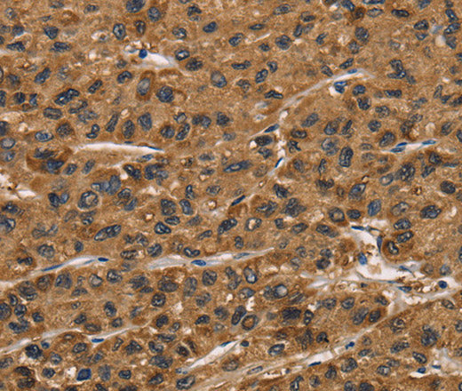 ATP7A Polyclonal Antibody – Figure 1 of 3