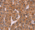 CARD11 Polyclonal Antibody – Figure 1 of 3
