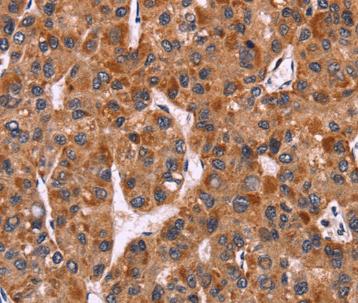 CARD11 Polyclonal Antibody – Figure 1 of 3
