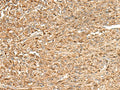 ZC3H7A Polyclonal Antibody – Figure 1 of 3