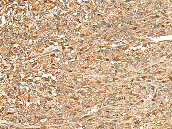 ZC3H7A Polyclonal Antibody – Figure 1 of 3