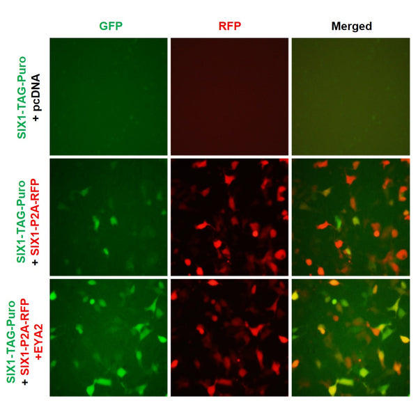 SIX1 Reporter Lentivirus – Figure 1 of 7