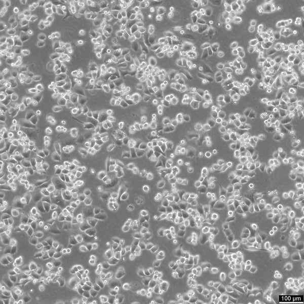 SK-BR-3 cell