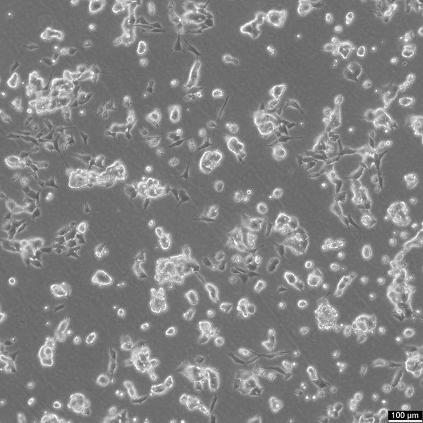 SK-ES-1 cell