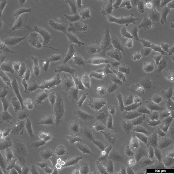 SK-LU-1 cell
