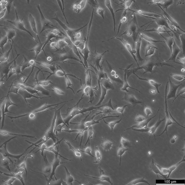 SK-MEL-28 cell