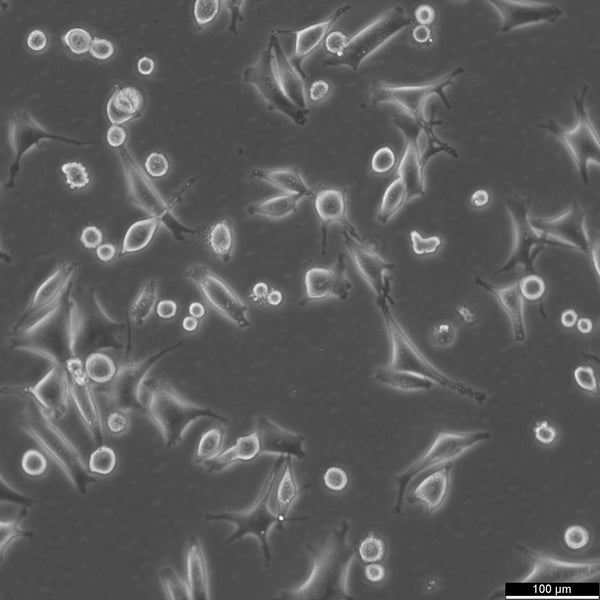 SK-MEL-5 cell
