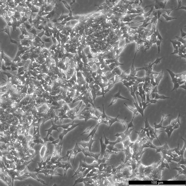 SK-N-BE(2) cell