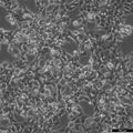 SK-N-LO cell
