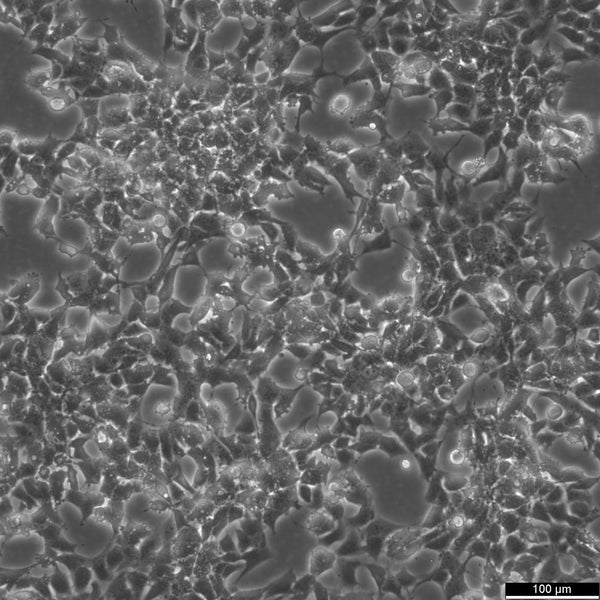SK-N-LO cell