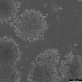 SK-NEP-1 cell