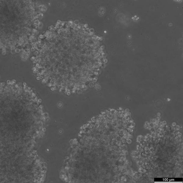 SK-NEP-1 cell