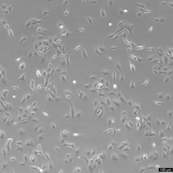 SK-OV-3 cell