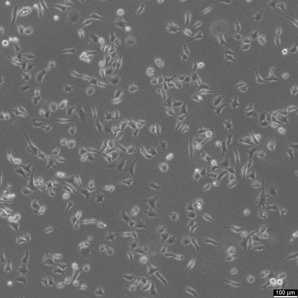 SK-UT-1 cell