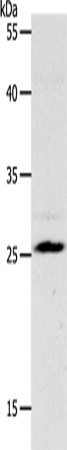 NQO2 Polyclonal Antibody – Figure 1 of 4