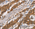 DSC2 Polyclonal Antibody – Figure 1 of 3