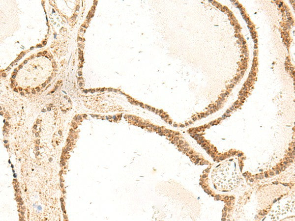 ZFYVE27 Polyclonal Antibody – Figure 1 of 2
