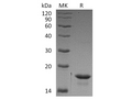 Recombinant Human 4E-BP1/EIF4EBP1 Protein (His Tag) – Figure 1 of 2
