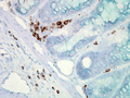 Mouse Anti-Hsp70 Antibody [C92F3A-5] used in Immunohistochemistry (IHC) on Mouse colon carcinoma (SMC-100)