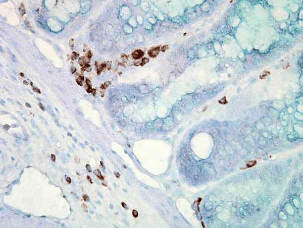 Mouse Anti-Hsp70 Antibody [C92F3A-5] used in Immunohistochemistry (IHC) on Mouse colon carcinoma (SMC-100)