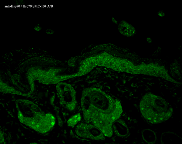 Mouse Anti-Hsp70 Antibody [N27F3-4] used in Immunohistochemistry (IHC) on Mouse backskin (SMC-104)
