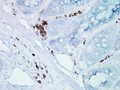 Mouse Anti-Hsp70 Antibody [BB70] used in Immunohistochemistry (IHC) on Mouse inflamed colon (SMC-106)