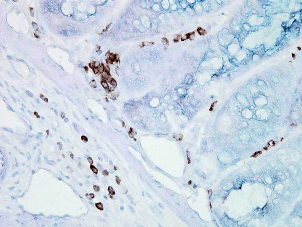 Mouse Anti-Hsp70 Antibody [BB70] used in Immunohistochemistry (IHC) on Mouse inflamed colon (SMC-106)