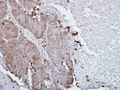Mouse Anti-Hsp90 alpha Antibody [K41009] used in Immunohistochemistry (IHC) on Human colon carcinoma (SMC-108)