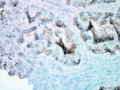 Mouse Anti-Hsp60 Antibody [LK-2] used in Immunohistochemistry (IHC) on Human colon carcinoma (SMC-111)