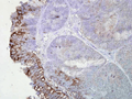 Mouse Anti-Hsp90 Antibody [AC-16] used in Immunohistochemistry (IHC) on Human colon carcinoma (SMC-112)