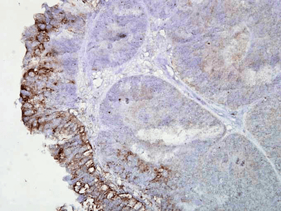 Mouse Anti-Hsp90 Antibody [AC-16] used in Immunohistochemistry (IHC) on Human colon carcinoma (SMC-112)