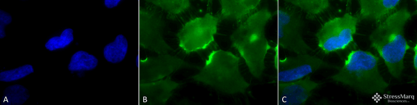 Mouse Anti-CD74 Antibody [PIN 1.1] used in Immunocytochemistry/Immunofluorescence (ICC/IF) on Human Cervical cancer cell line (HeLa) (SMC-116)