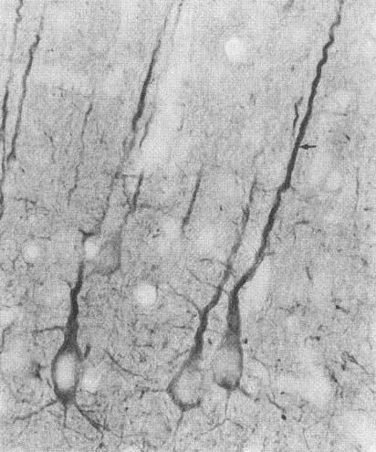 Mouse Anti-PSD95 Antibody [7E3] used in Immunohistochemistry (IHC) on Rat Neocortex (SMC-123)