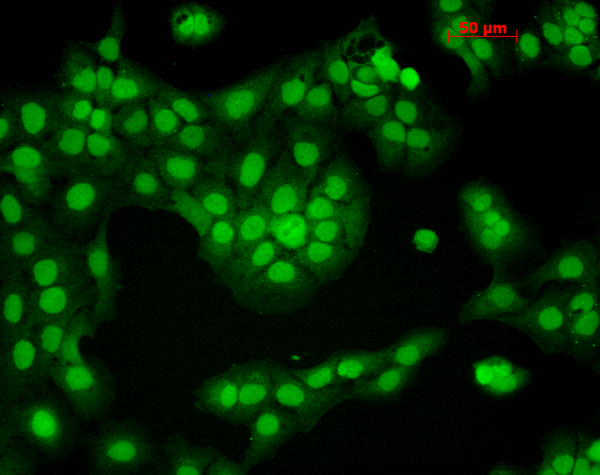Mouse Anti-CaMKII Antibody [6G9] used in Immunocytochemistry/Immunofluorescence (ICC/IF) on Human HaCaT cells (SMC-124)