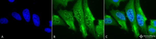 Mouse Anti-HO-1 Antibody [1F12-A6] used in Immunocytochemistry/Immunofluorescence (ICC/IF) on Human Cervical cancer cell line (HeLa) (SMC-131)