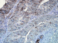 Mouse Anti-Hsp90 Antibody [D7alpha] used in Immunohistochemistry (IHC) on Human colon carcinoma (SMC-137)