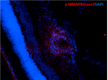 Mouse Anti-p38 MAPK Antibody [9F12] used in Immunohistochemistry (IHC) on Mouse Retinal Injury Model (SMC-152)