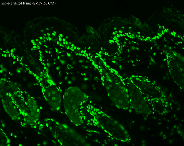 Mouse Anti-Acetylated Lysine Antibody [7F8] used in Immunohistochemistry (IHC) on Mouse backskin (SMC-153)