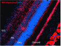 Mouse Anti-Nitrotyrosine Antibody [39B6] used in Immunohistochemistry (IHC) on Mouse Retinal Injury Model (SMC-154)