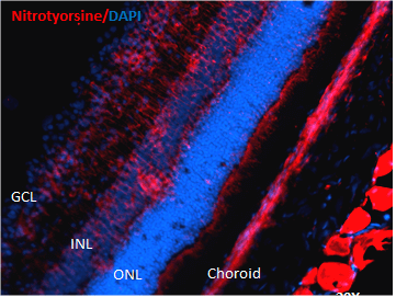 Mouse Anti-Nitrotyrosine Antibody [39B6] used in Immunohistochemistry (IHC) on Mouse Retinal Injury Model (SMC-154)