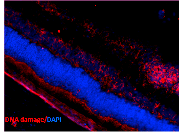 Mouse Anti-DNA Damage Antibody [15A3] used in Immunohistochemistry (IHC) on Mouse Retinal Injury Model (SMC-155)