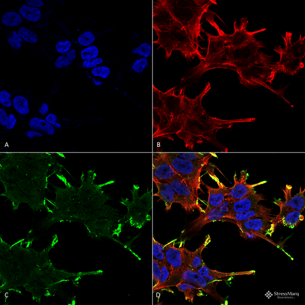 Mouse Anti-Alpha B Crystallin Antibody [1A7.D5] used in Immunocytochemistry/Immunofluorescence (ICC/IF) on Human Neuroblastoma cell line (SK-N-BE) (SMC-159)