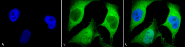Mouse Anti-Ubiquitin Antibody [5B9-B3] used in Immunocytochemistry/Immunofluorescence (ICC/IF) on Human Cervical cancer cell line (HeLa) (SMC-160)