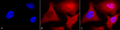 Mouse Anti-Ubiquitin Antibody [6C11-B3] used in Immunocytochemistry/Immunofluorescence (ICC/IF) on Human Cervical cancer cell line (HeLa) (SMC-171)