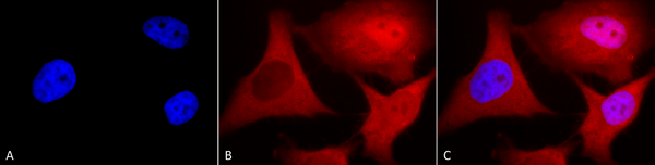 Mouse Anti-Ubiquitin Antibody [6C11-B3] used in Immunocytochemistry/Immunofluorescence (ICC/IF) on Human Cervical cancer cell line (HeLa) (SMC-171)