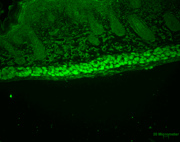 Rat Anti-Aha1 Antibody [25F2.D9] used in Immunohistochemistry (IHC) on Mouse backskin (SMC-172)