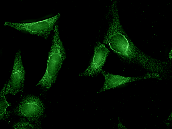 Rat Anti-Aha1 Antibody [25F2.D10] used in Immunocytochemistry/Immunofluorescence (ICC/IF) on Human Cervical cancer cell line (HeLa) (SMC-173)